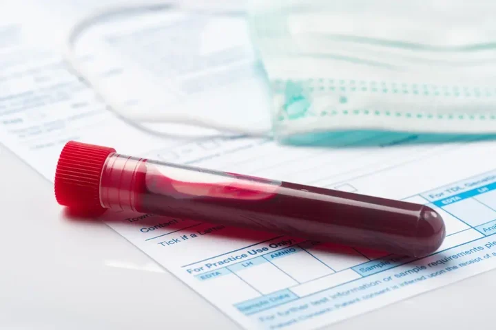 Dlaczego regularne badania krwi są tak ważne?